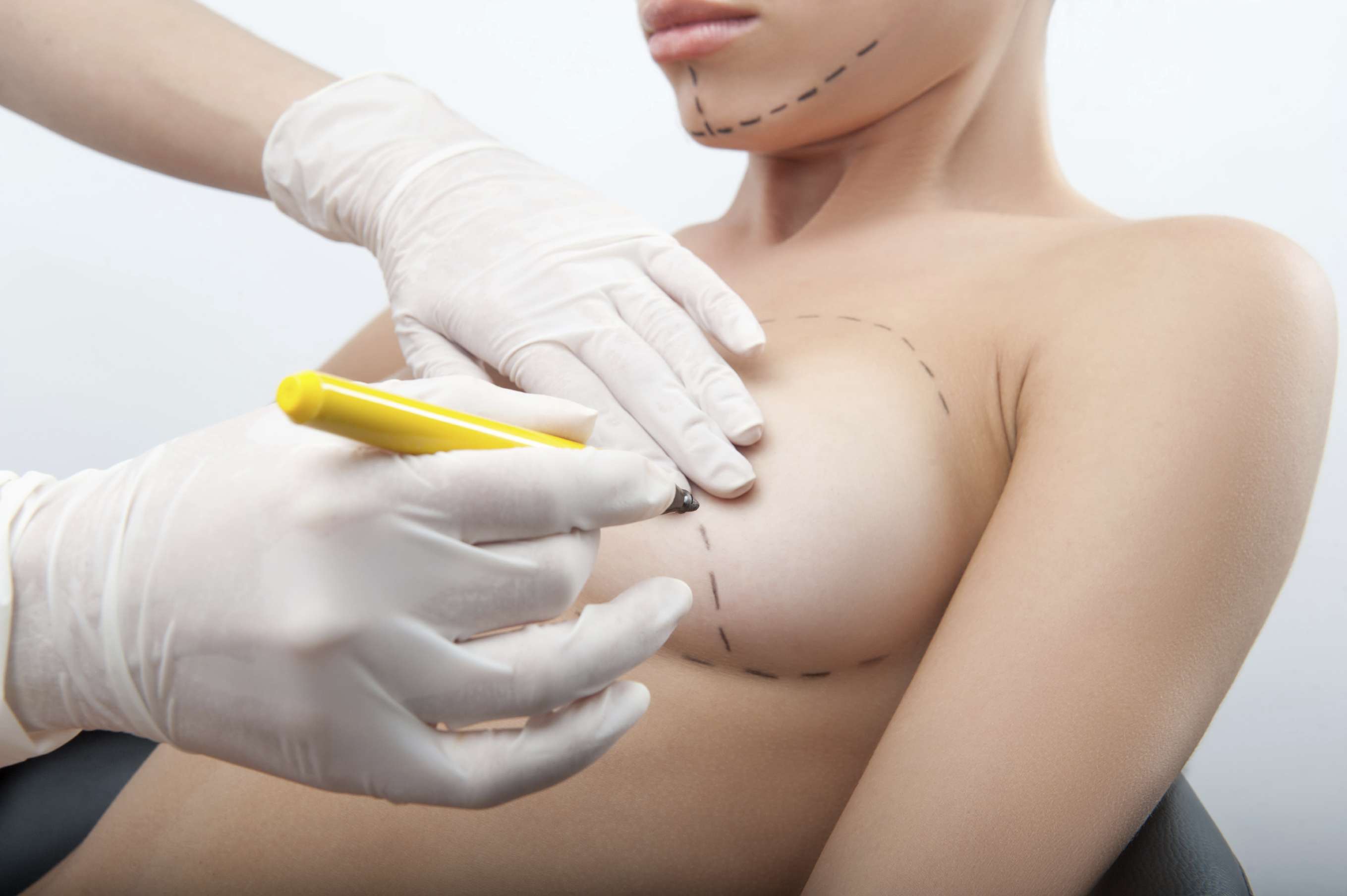 Injection Graisse Seins Alternative Naturelle Aux Implants Mammaire